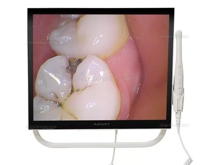 Magenta YFHD-D Dental Intraoral Camera 1/4 sony CCD with 17 Inch Monitor & Bracket